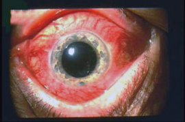 MY PRECIOUS EYES - THE GORY STORY - 13 Min.