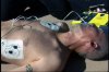 AED - AUTOMATED EXTERNAL DEFIBRILLATORS - 12 Min.