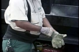 HAND INJURIES - THE GORY STORY - 14 Min.