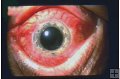 MY PRECIOUS EYES - THE GORY STORY - 13 Min.